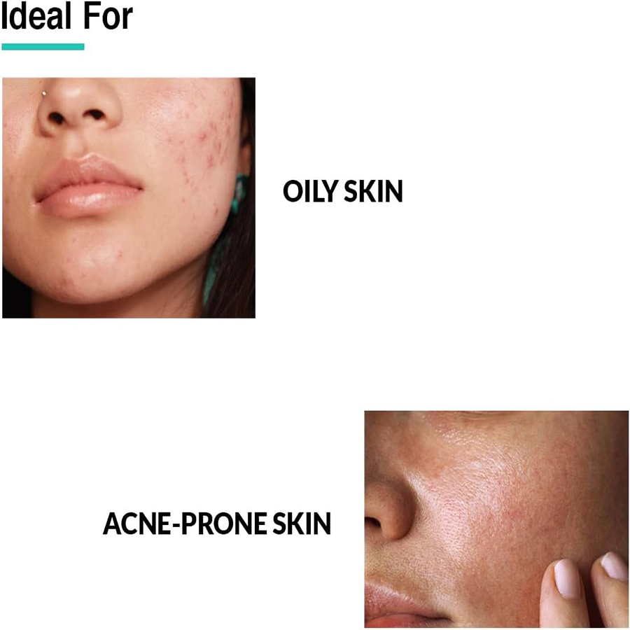 Fixderma - Anti-Acne Face Serum - 30 gm