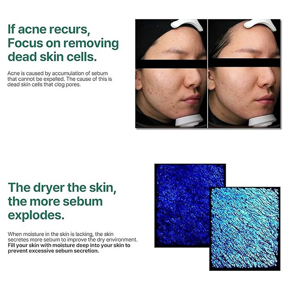 سوم باي مي - تونر معجزة 30 يوم بأحماض ألفا وبيتا وبولي هيدروكسي - 150 مل