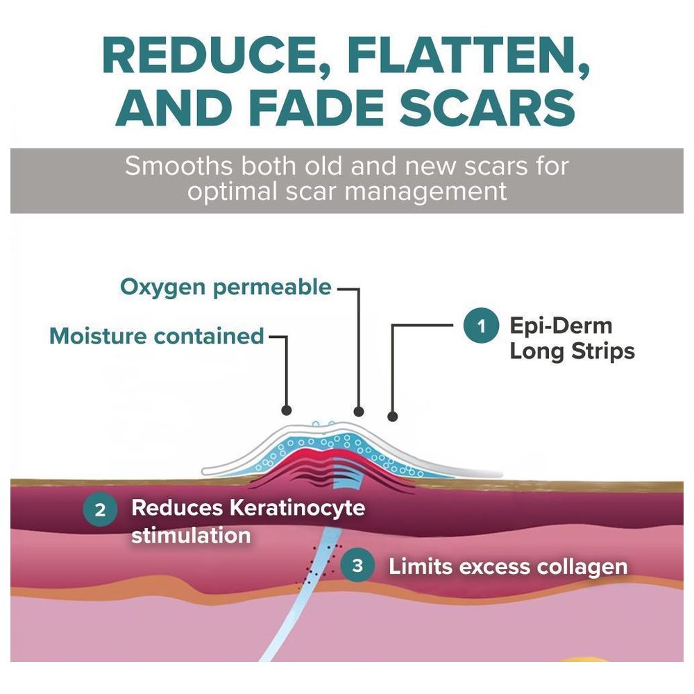 Bioderms - Epiderm Long Natural Silicone Scar Sheet - 2 Pcs