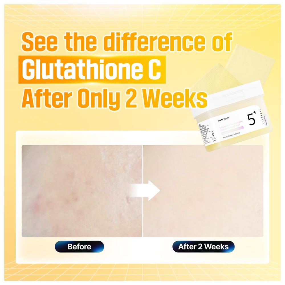 نومبوزين - شرائح فيتامين نياسيناميد رقم 5 - 180 مل - 70 قطعة