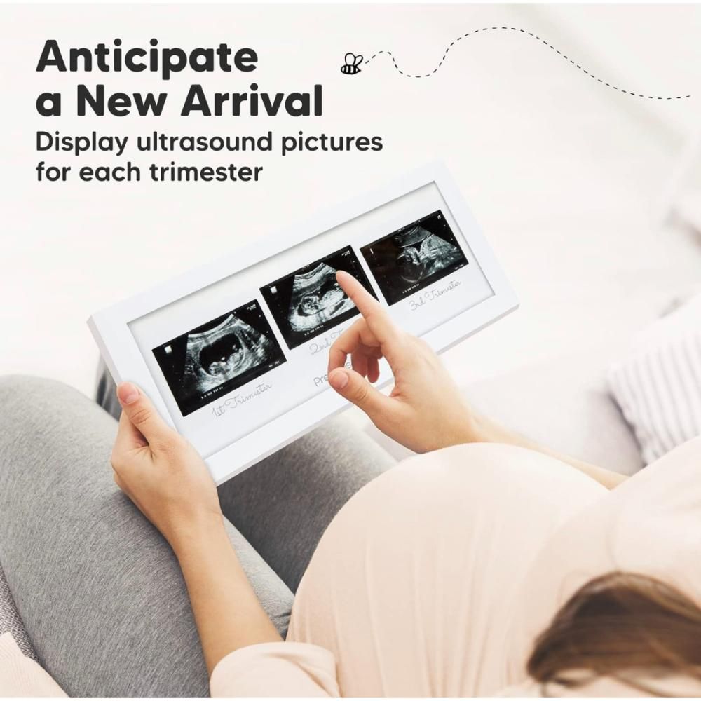 Keababies - Trio Sonogram Frame - Alpine White