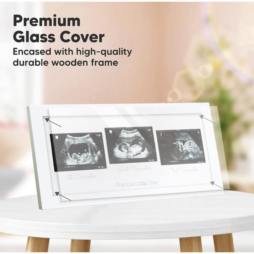 Keababies - Trio Sonogram Frame - Alpine White
